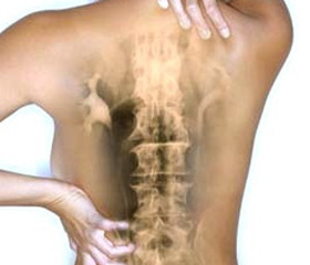 Симптомы остеохондроза грудной клетки