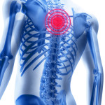 Признаки остеохондроза грудного отдела позвоночника